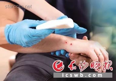 男子被蝮蛇咬伤全市无适配血清解决方案