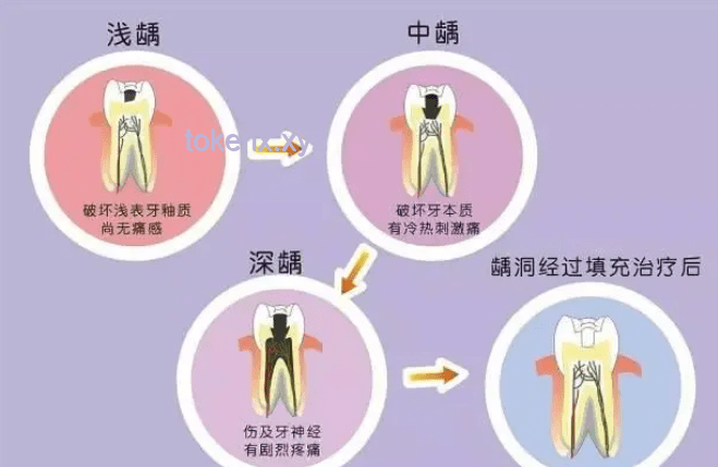 牙医预警与韦东奕牙周危机：从预防到治疗的对比分析